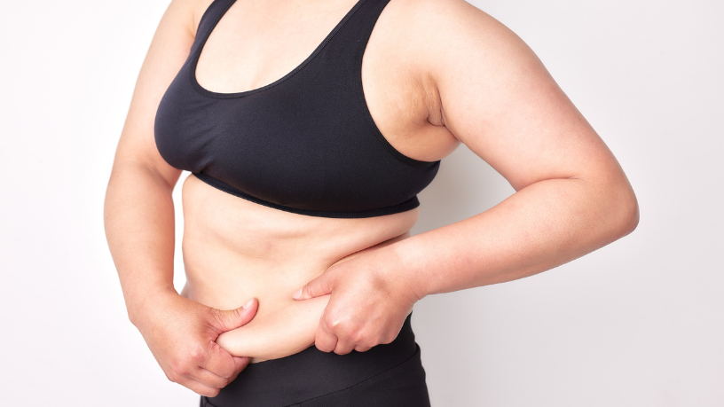 A abdominoplastia é uma solução eficaz para quem busca definição e autoestima, explica Dr. Milton Seigi Hayashi.